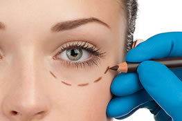 Eyelid surgery